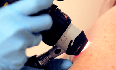 Métodos de diagnóstico para a granxa plantar