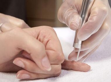 Realización de terapia láser