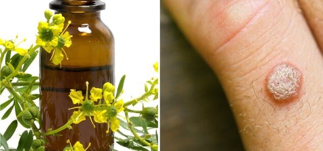 Tratamento das verrugas con celidonia farmacéutica