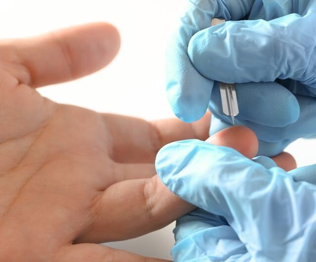 Diagnosticar o VPH no corpo